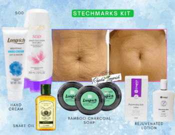 stretch marks kit